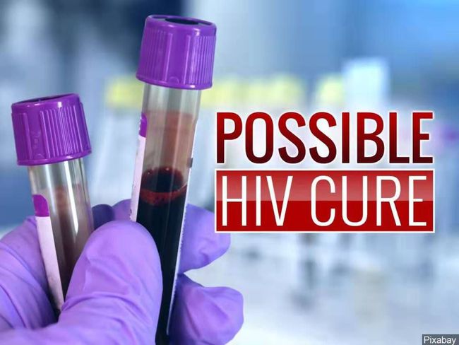 确诊感染HIV后怎么办？